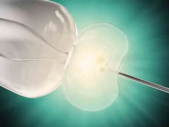 试管婴儿都有什么检查