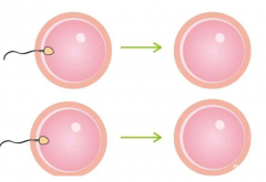 做试管婴儿第一次要交多少钱？伊朗试管婴儿