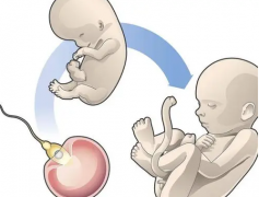 做试管婴儿周期要打几天排卵针，伊朗试管婴儿