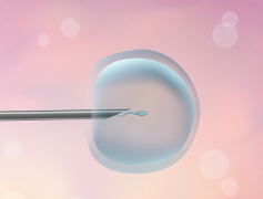 伊朗做试管婴儿要取多少个卵子