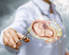 一代试管婴儿缺陷