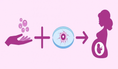 做试管婴儿微刺方案，伊朗试管婴儿